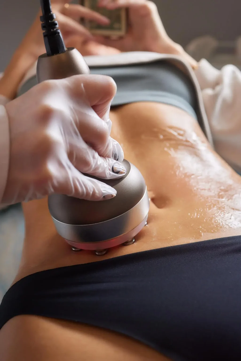 Lydia Esthetics Embassy A person receives a body contouring treatment with a handheld device on their abdomen; the technician is wearing gloves and the skin appears to be covered in gel. New York