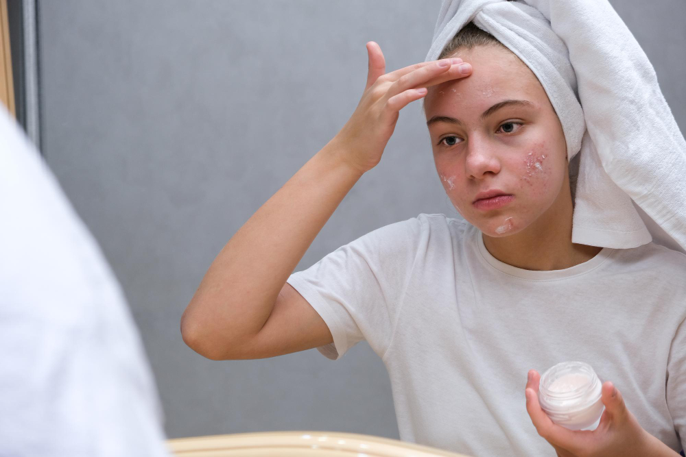 Lydia Esthetics Embassy A young person with a towel on their head applies cream to their face, which shows signs of acne or irritation, while looking in a bathroom mirror. New York